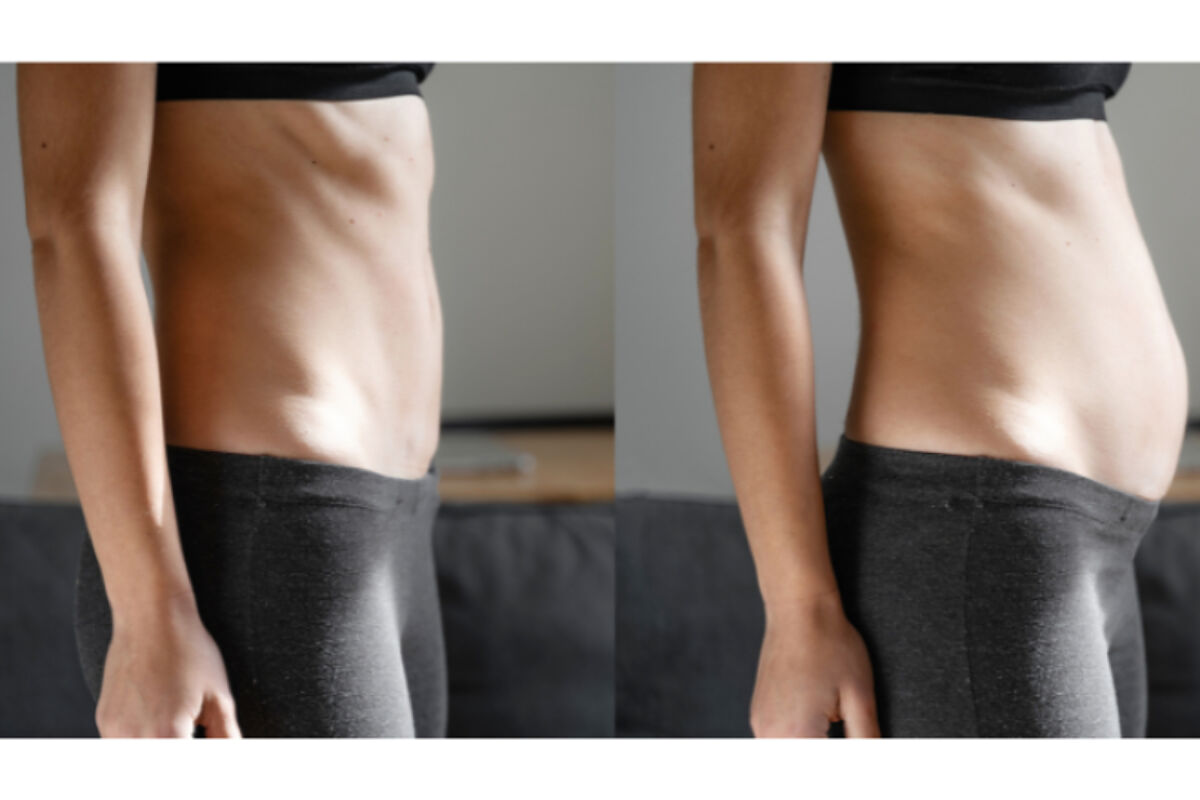 SIBO ¿Qué es? Síntomas, Causas y Cómo Sanar